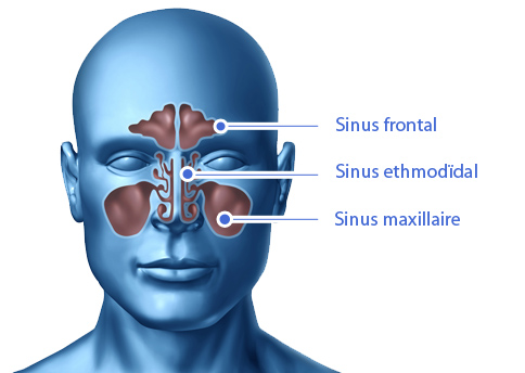 La sinusite ou affection des sinus – Pharmunix